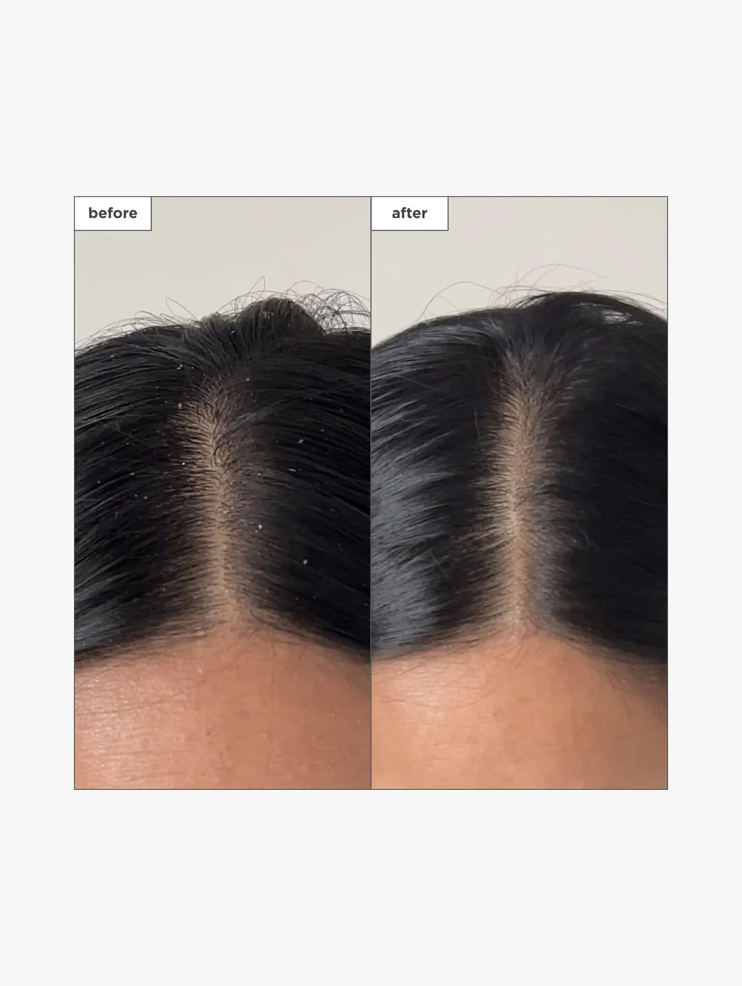 Alternative Image Briogeo Scalp Revival Charcoal& Tea Tree Build Up Detox Spray 120ml