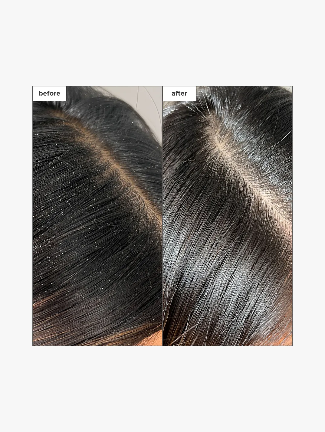 Alternative Image Briogeo Scalp Revival Charcoal& Tea Tree Build Up Detox Spray 120ml