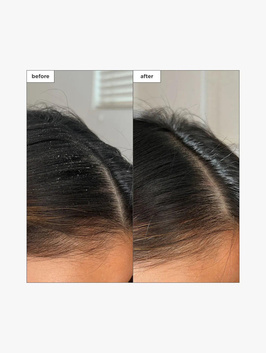Alternative Image Briogeo Scalp Revival Charcoal& Tea Tree Build Up Detox Spray 120ml