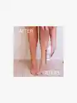 Alternative Image This Works Perfect Leg Skin Miracle