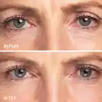 Alternative Image Skyn Iceland Dissolving Microneedle Eye Patch 5
