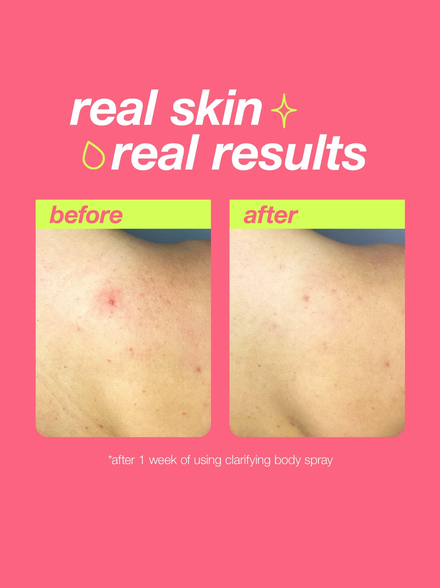 Alternative Image Dermalogica Clarifying Body Spray