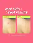 Alternative Image Dermalogica Clarifying Body Spray