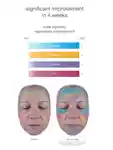 Alternative Image Dermalogica Smart Response Serum