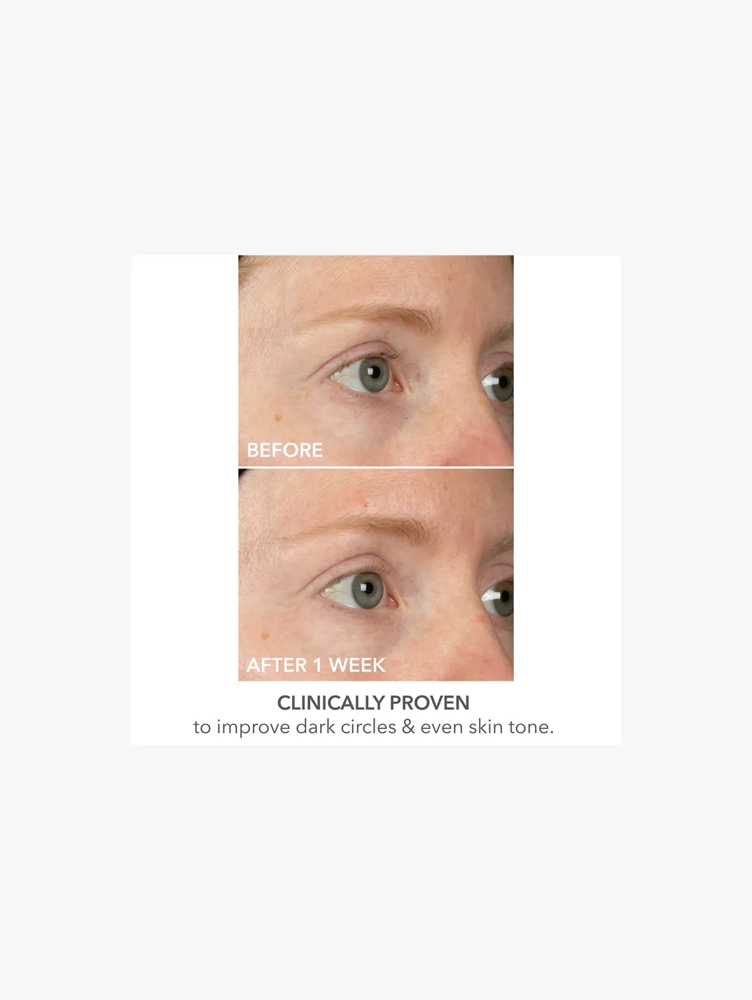 Alternative Image Dr Dennis Gross Derminfusion Eye Mask