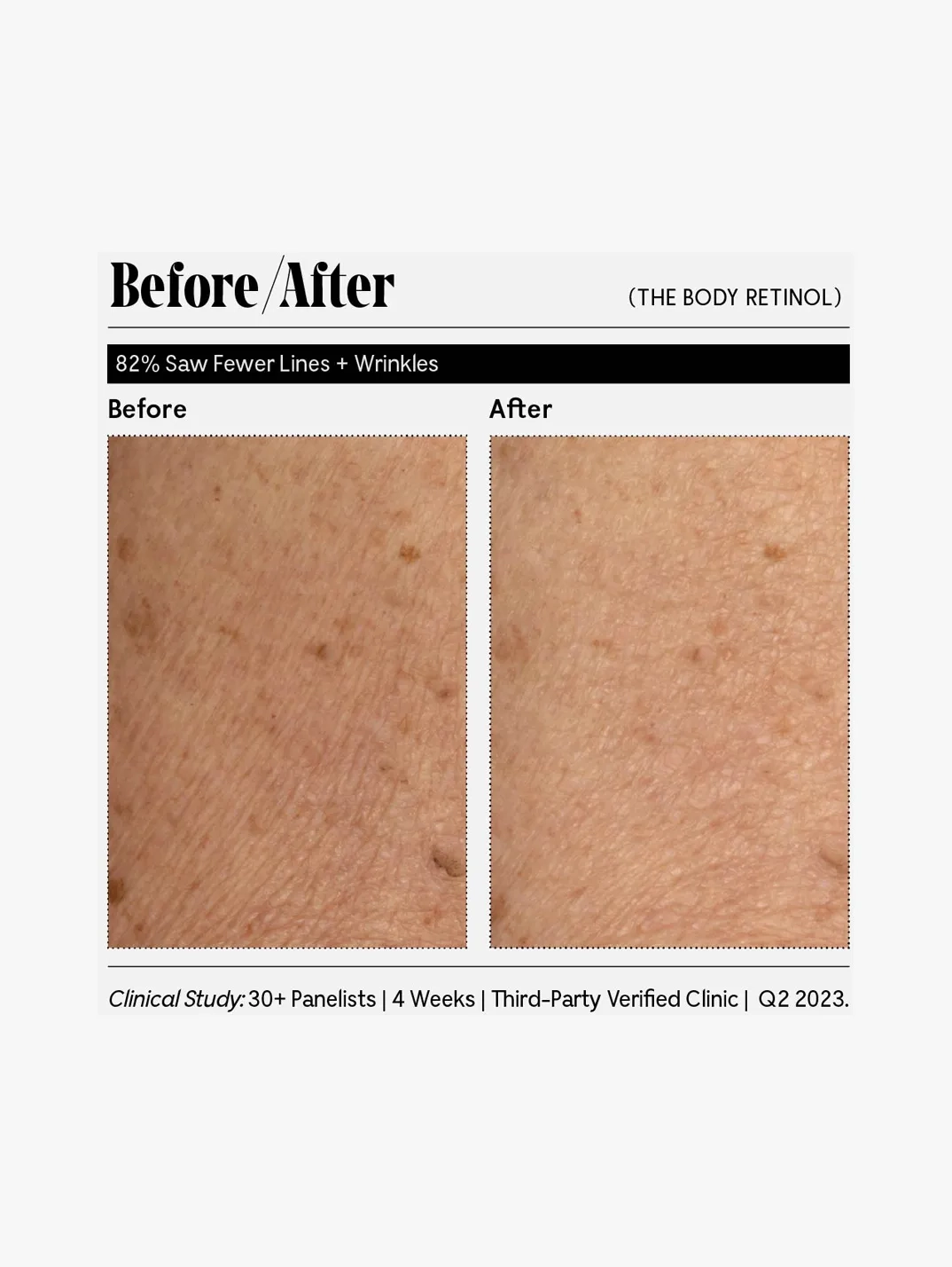 Alternative Image Necessaire The Body Retinol