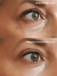 Alternative Image Goldfaden MD Eye Defy Radiance Restoring Eye Treatment