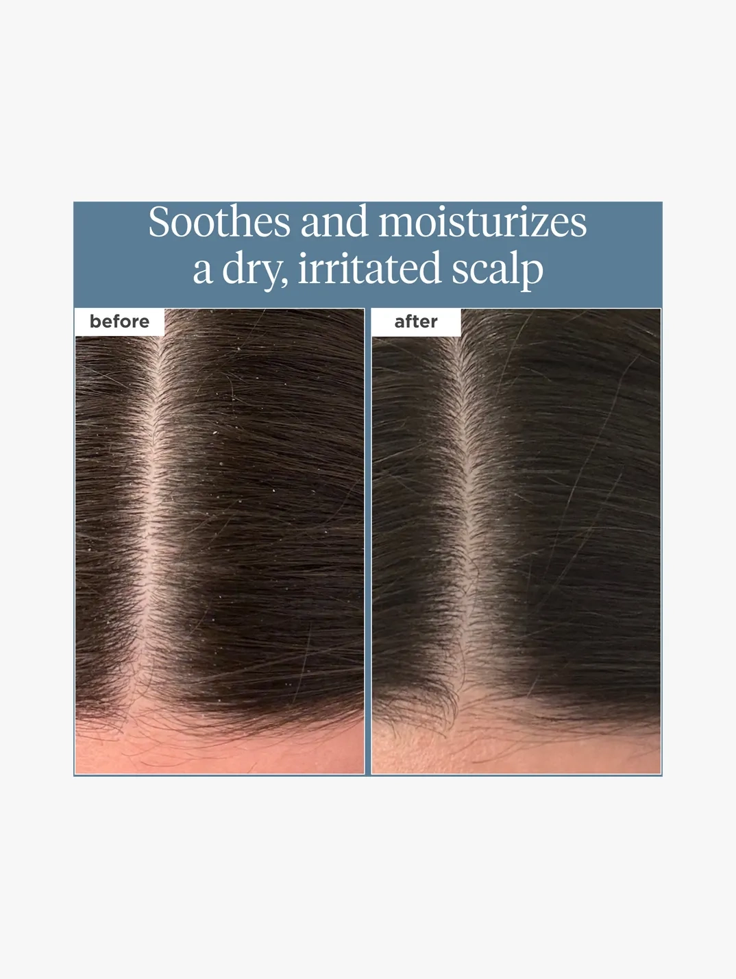 Alternative Image Briogeo Pre Wash Oil