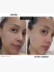 Alternative Image Kate Somerville Eradikate Daily Foaming Cleanser