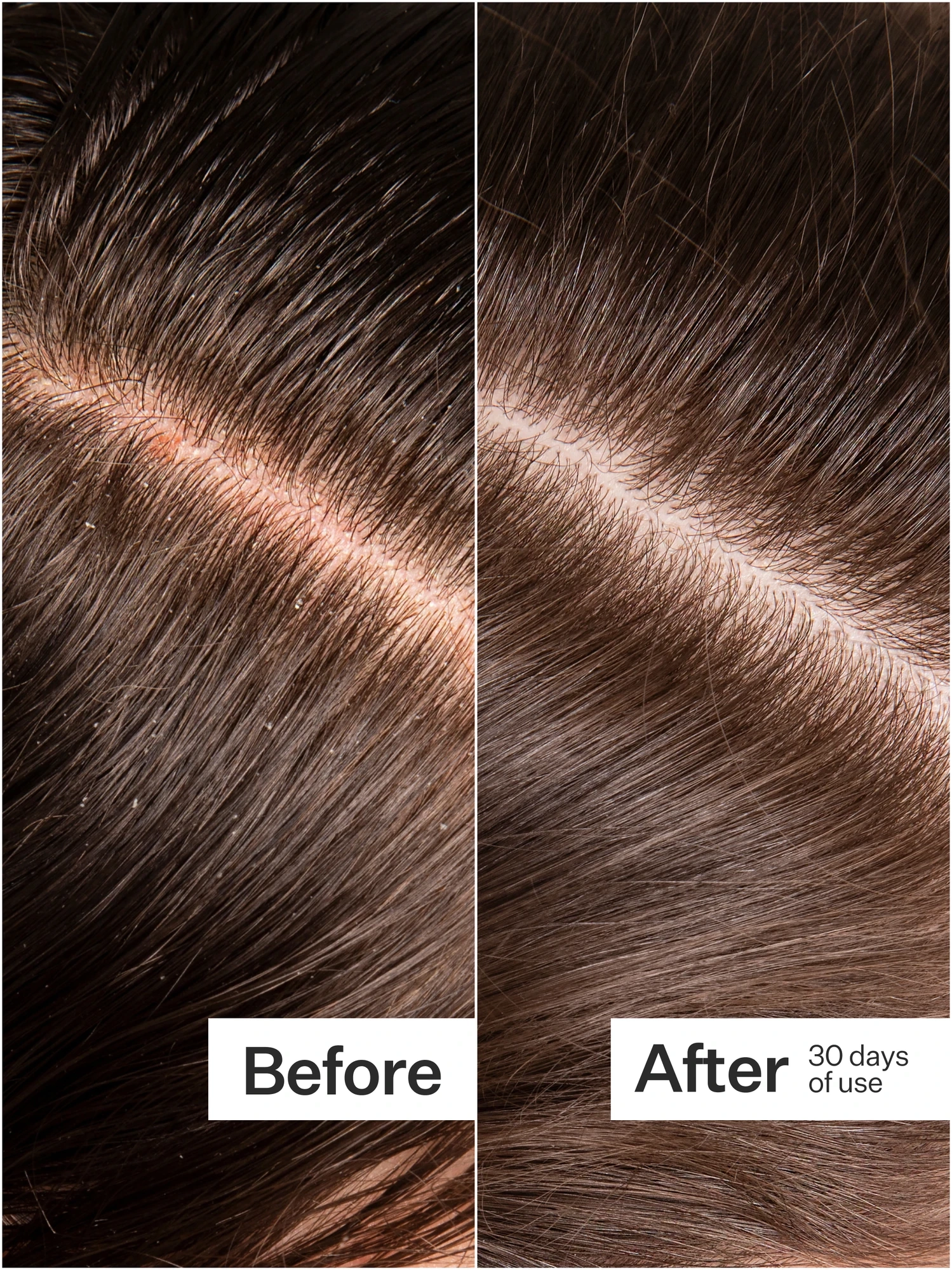 Alternative Image Act Acre Microbiome Cooling Serum