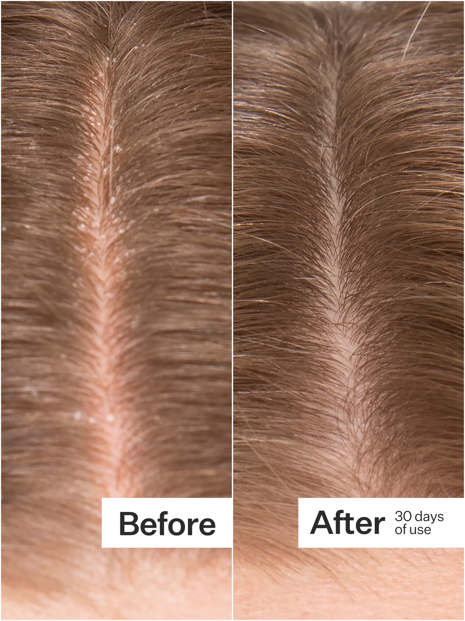 Alternative Image Act Acre Microbiome Cooling Serum