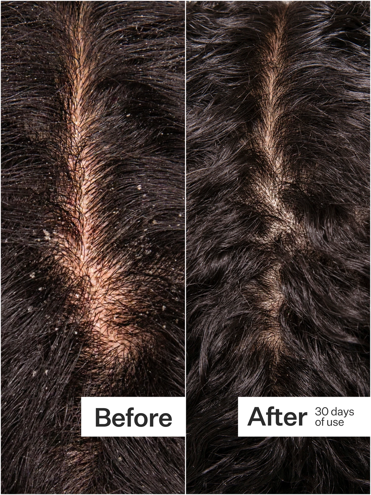 Alternative Image Act Acre Microbiome Cooling Serum