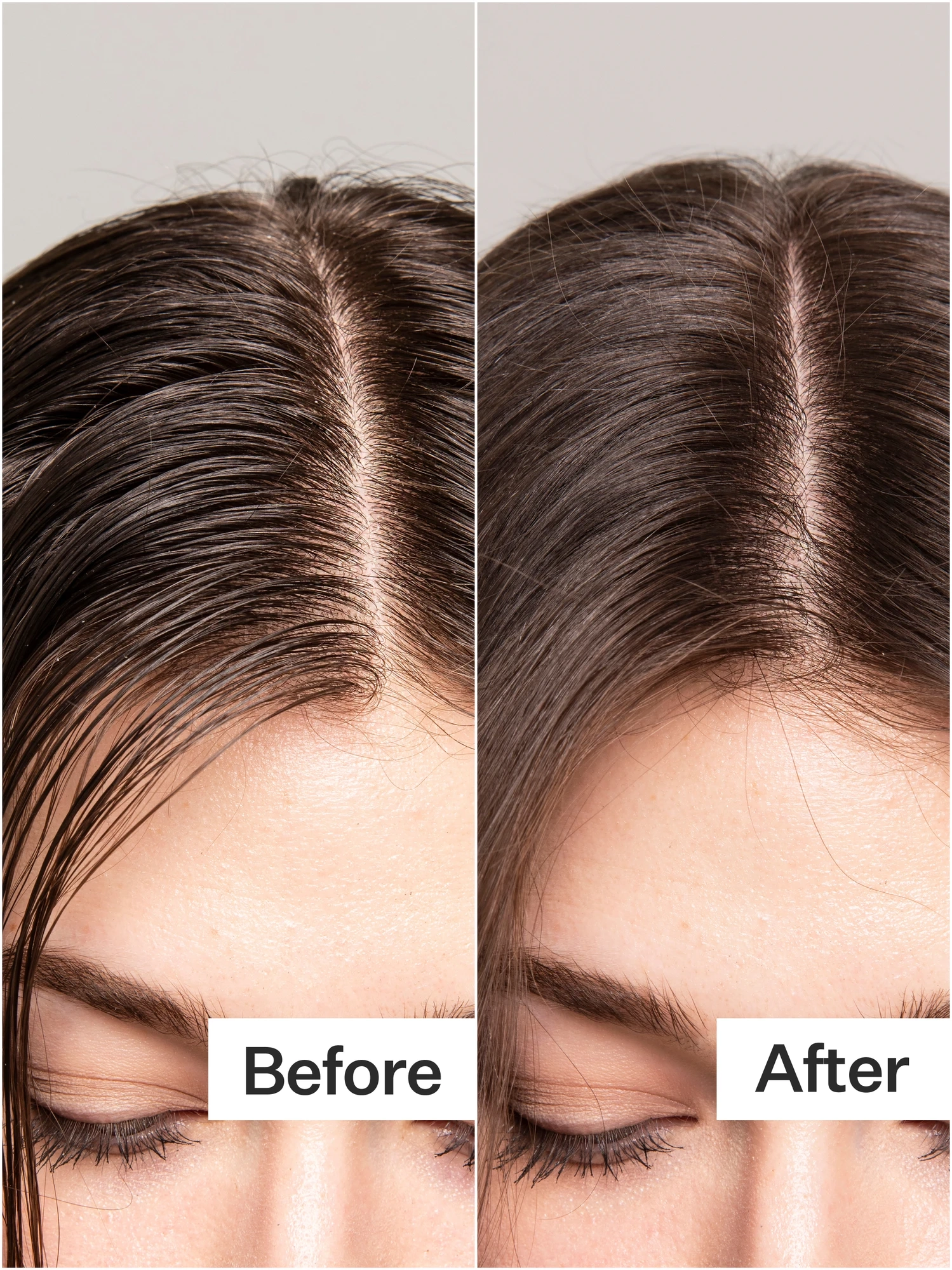 Alternative Image Act Acre Dry Shampoo