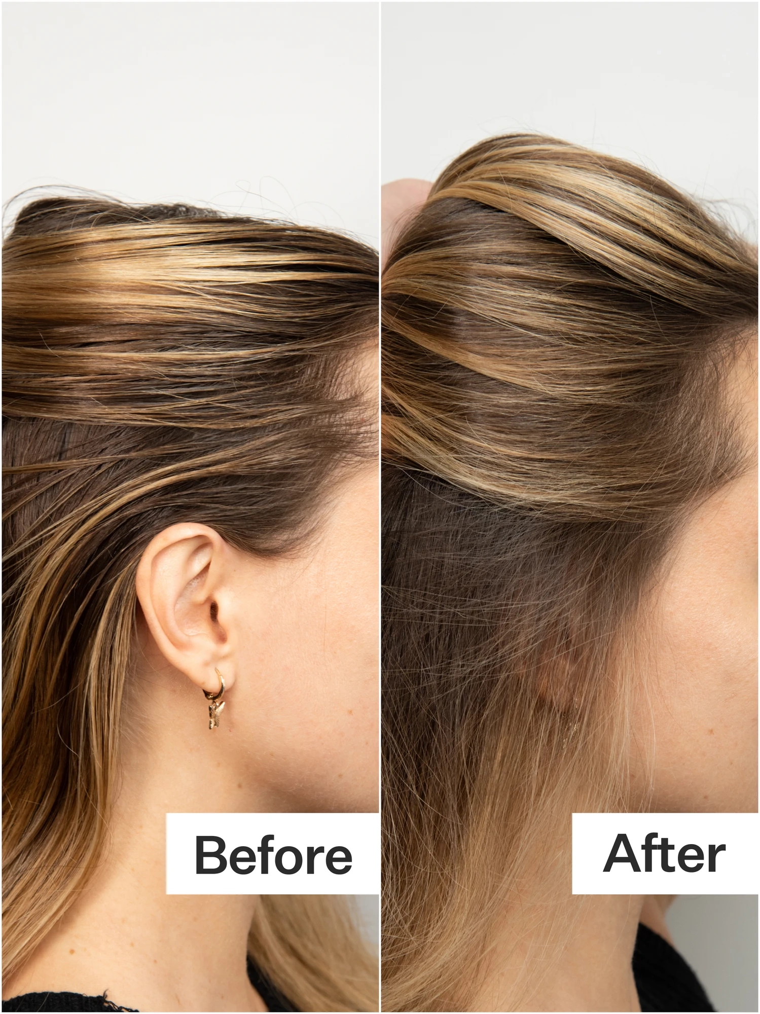 Alternative Image Act Acre Dry Shampoo