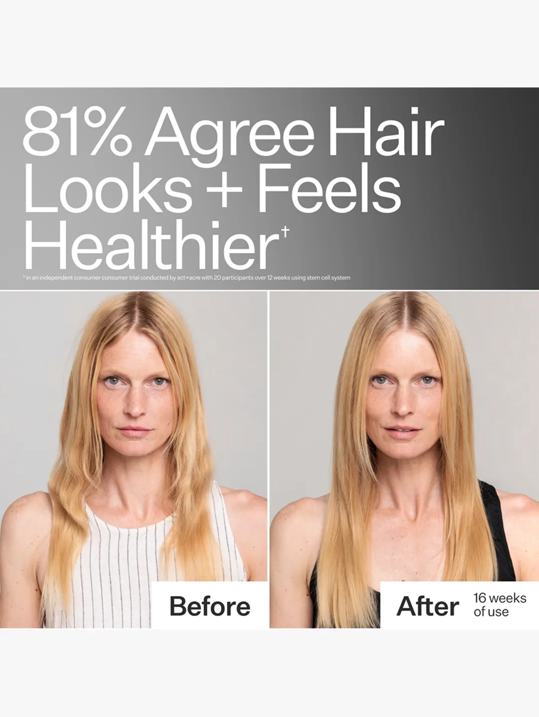 Alternative Image Act Acre Stem Cell Conditioner