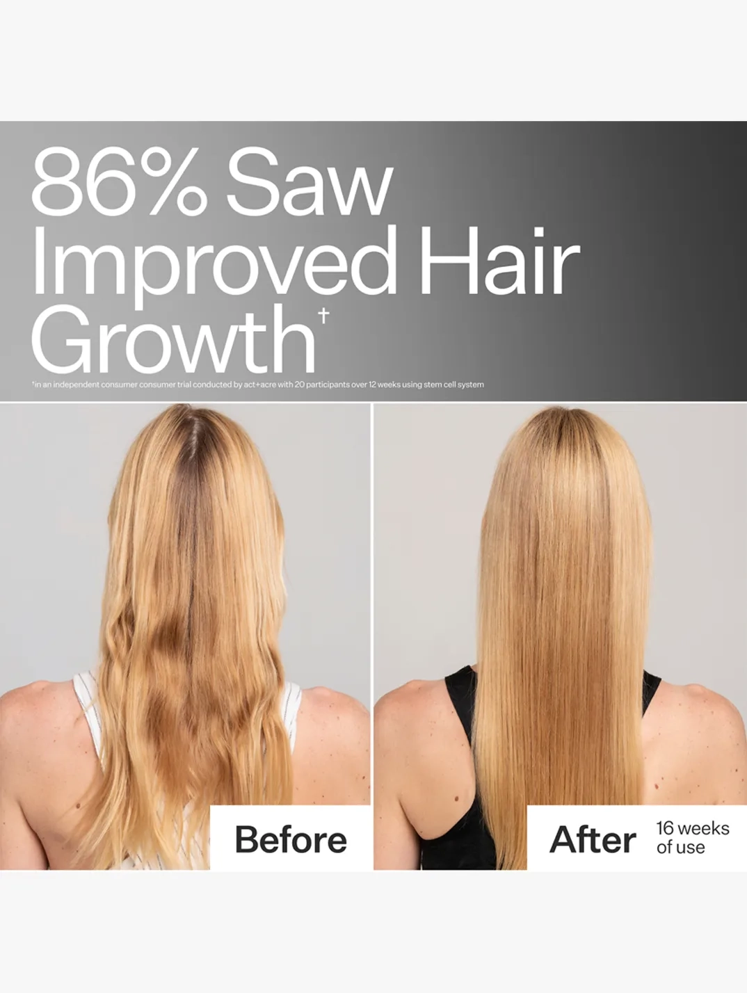 Alternative Image Act Acre Stem Cell Conditioner