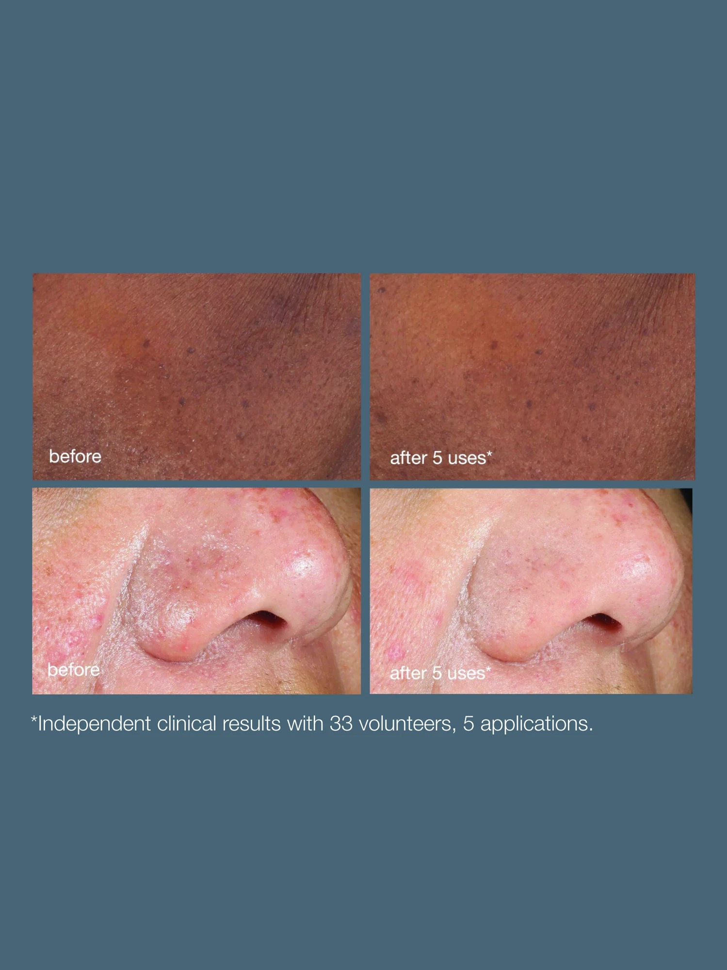 Alternative Image Dermalogica Powerbright Dark Spot Peel