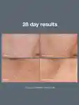 Alternative Image Dermalogica Powerbright Dark Spot System