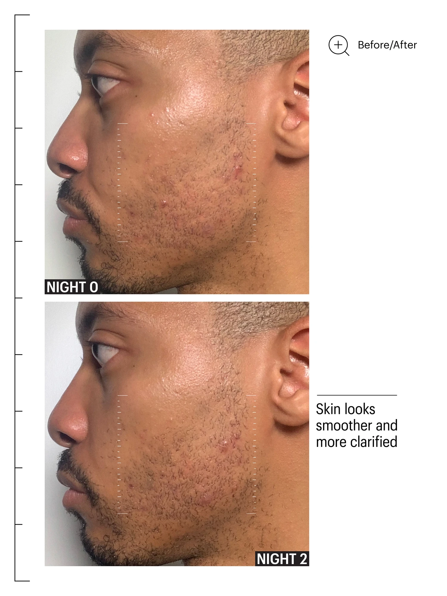 Alternative Image Allies Of Skin Multi Acids Retinoid Sleeping Facial