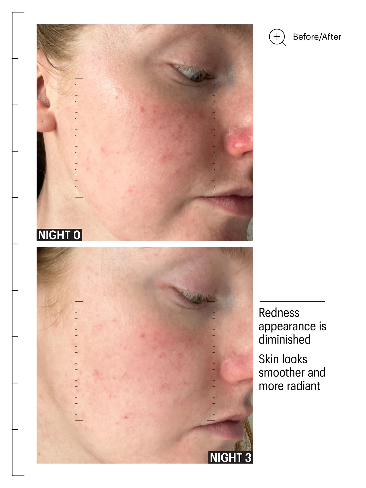 Alternative Image Allies Of Skin Multi Acids Retinoid Sleeping Facial