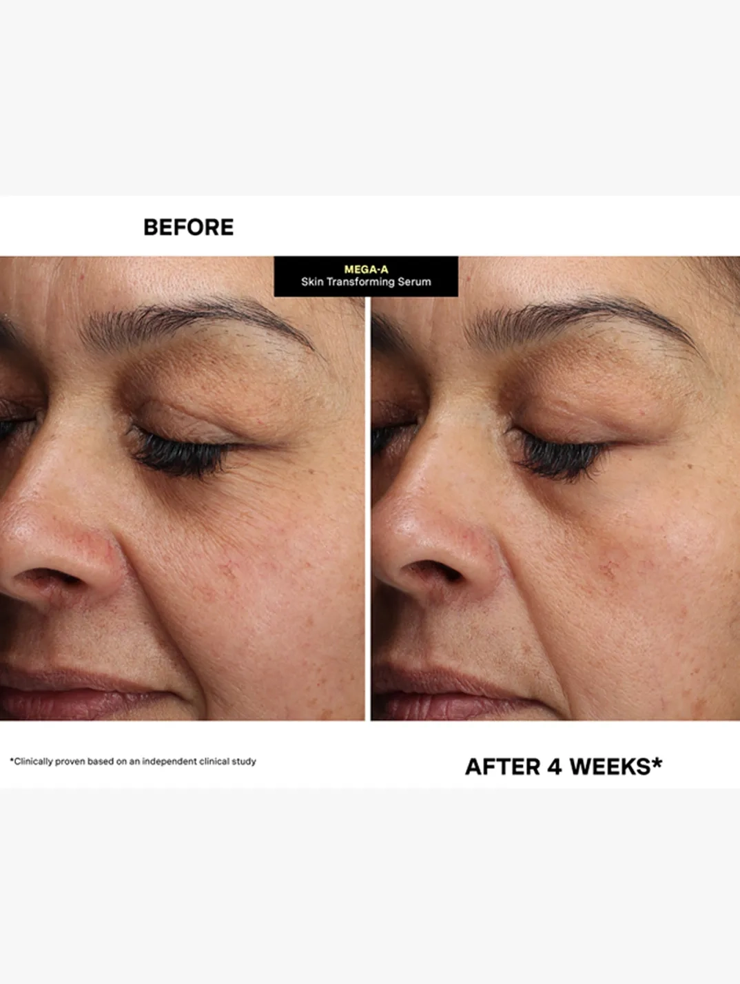 Alternative Image Kate Somerville Mega A Skin Transforming Serum