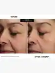 Alternative Image Kate Somerville Mega A Skin Transforming Serum