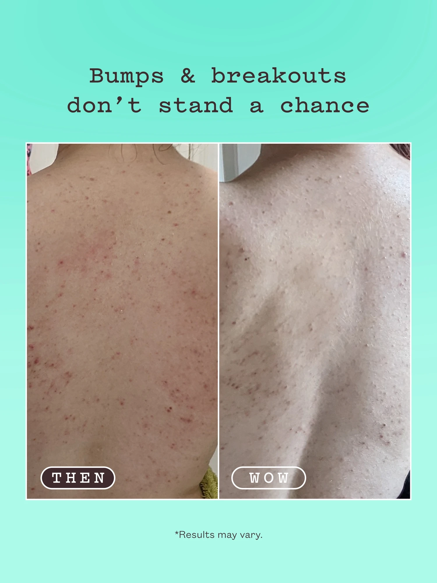 Alternative Image FRANKBODY Triple Acid Body Mist