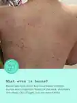 Alternative Image FRANKBODY Triple Acid Body Mist