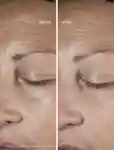 Alternative Image Omorovicza Queen Serum