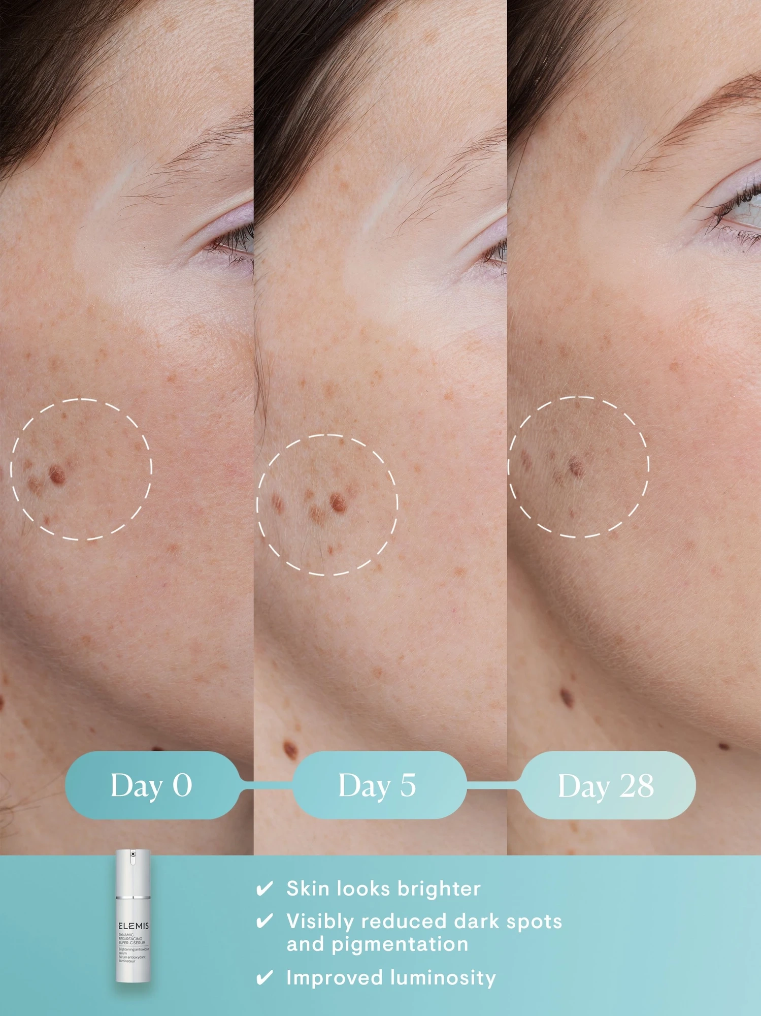 Alternative Image Elemis Dynamic Resurfacing Super Cserum