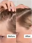 Alternative Image Act Acre Scalp Exfoliator