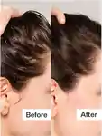 Alternative Image Act Acre Scalp Exfoliator