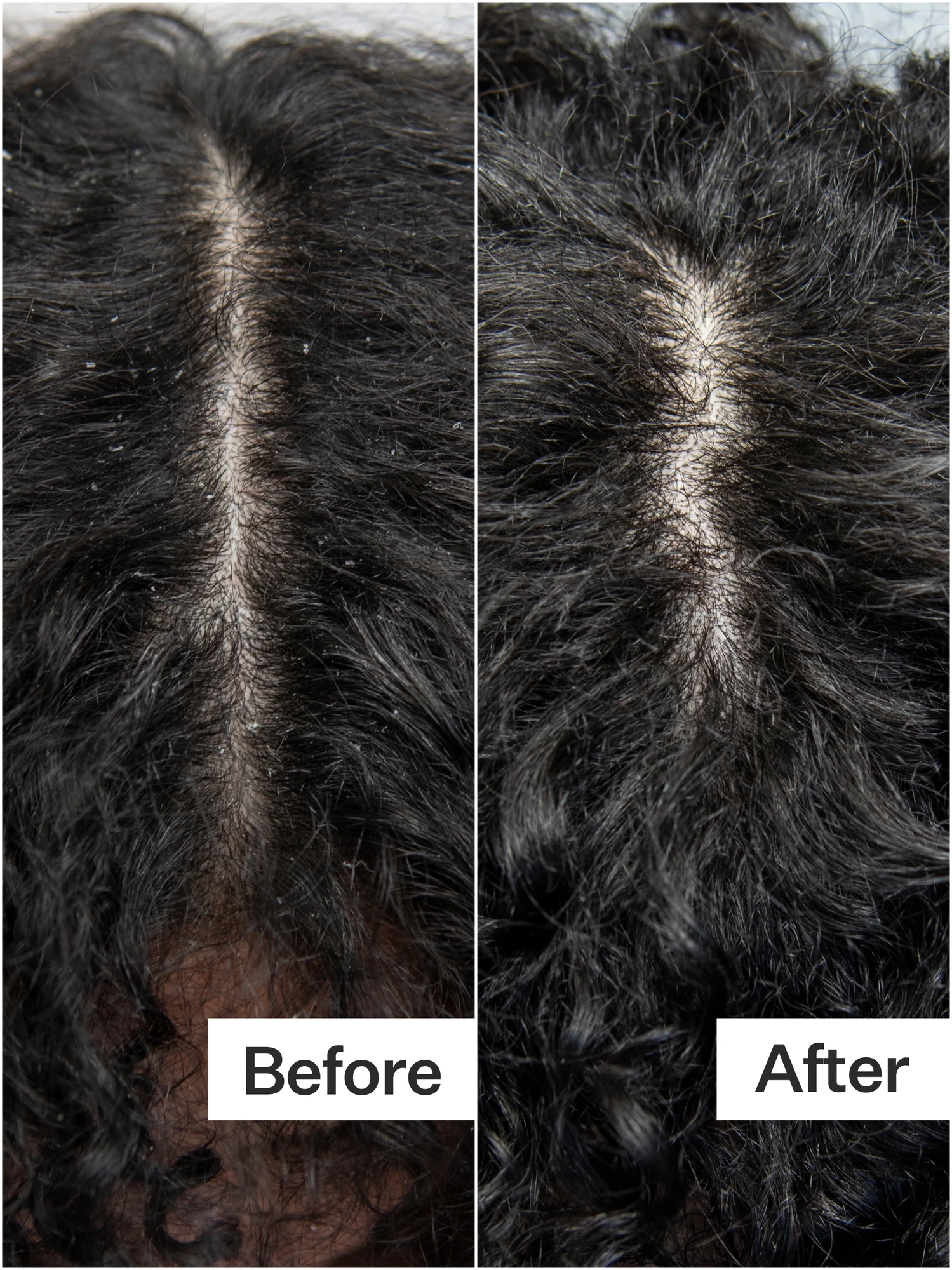 Alternative Image Act Acre Scalp Detox