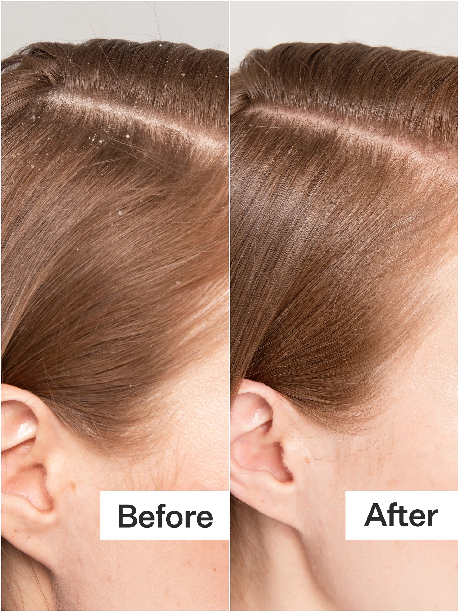 Alternative Image Act Acre Scalp Detox