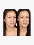 Alternative Image By Terry Brightening CC Foundation
