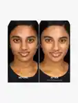 Alternative Image By Terry Brightening CC Foundation