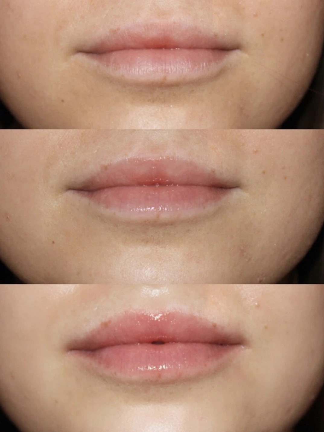Alternative Image Dr Lara Devgan Platinum Lip Plump