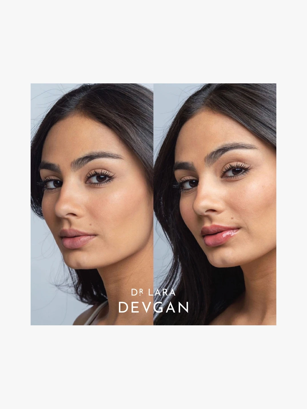 Alternative Image Dr Lara Devgan Platinum Lip Plump