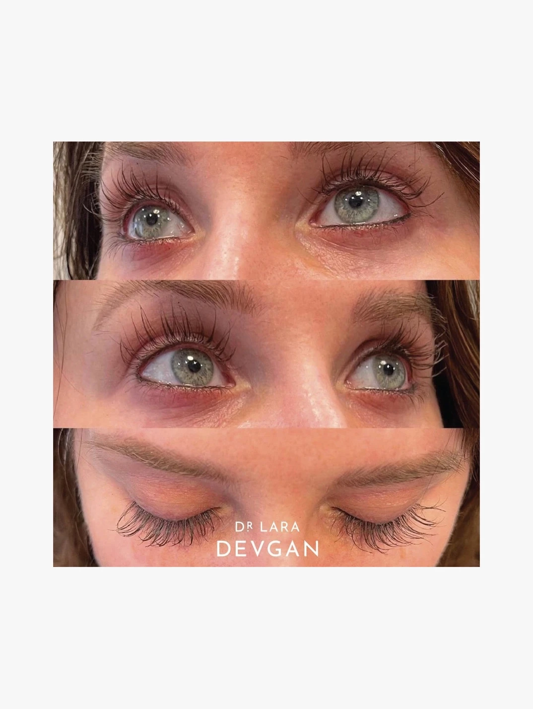 Alternative Image Dr Lara Devgan Platinum Long Lash