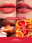 Alternative Image Tower28 Lip Softie Lip Treatment