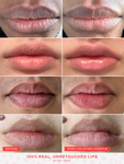 Alternative Image Tower28 Lip Softie Lip Treatment