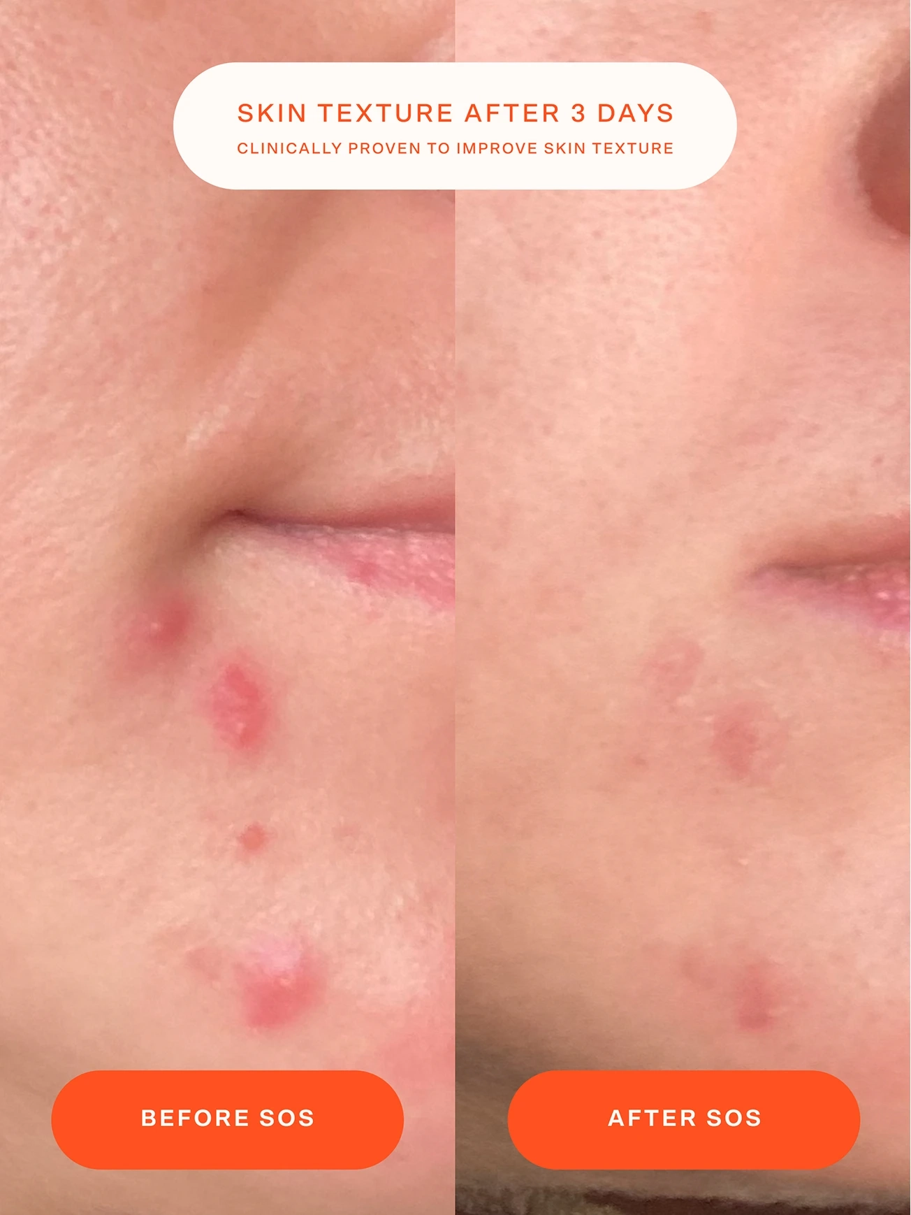 Alternative Image Tower28 SOS Daily Barrier Recovery Cream