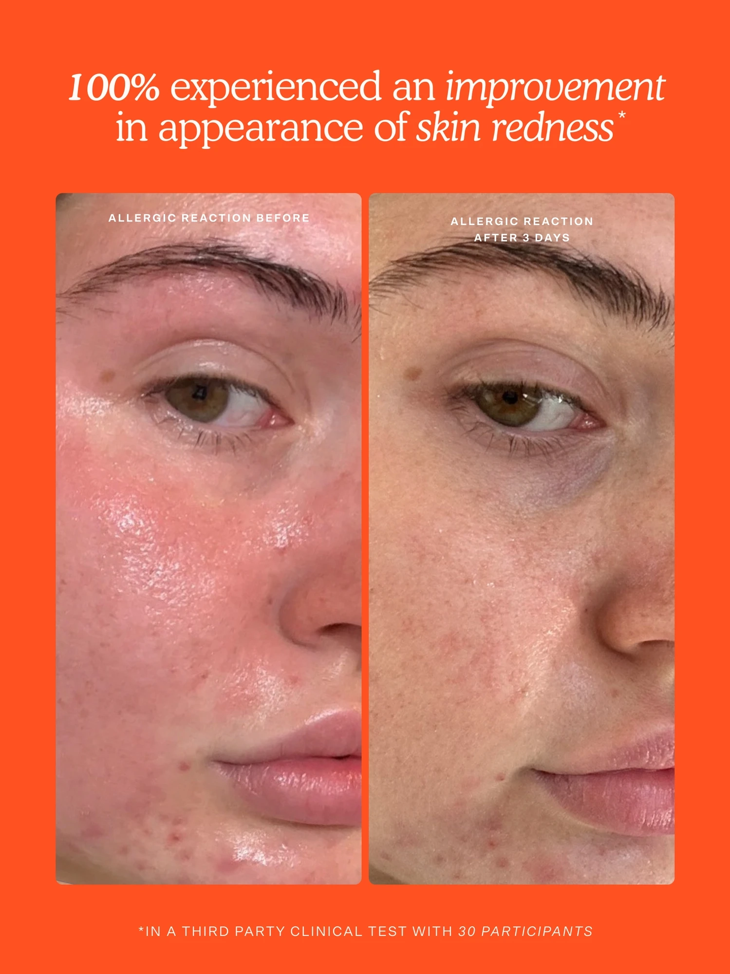Alternative Image Tower28 SOS Daily Rescue Facial Spray
