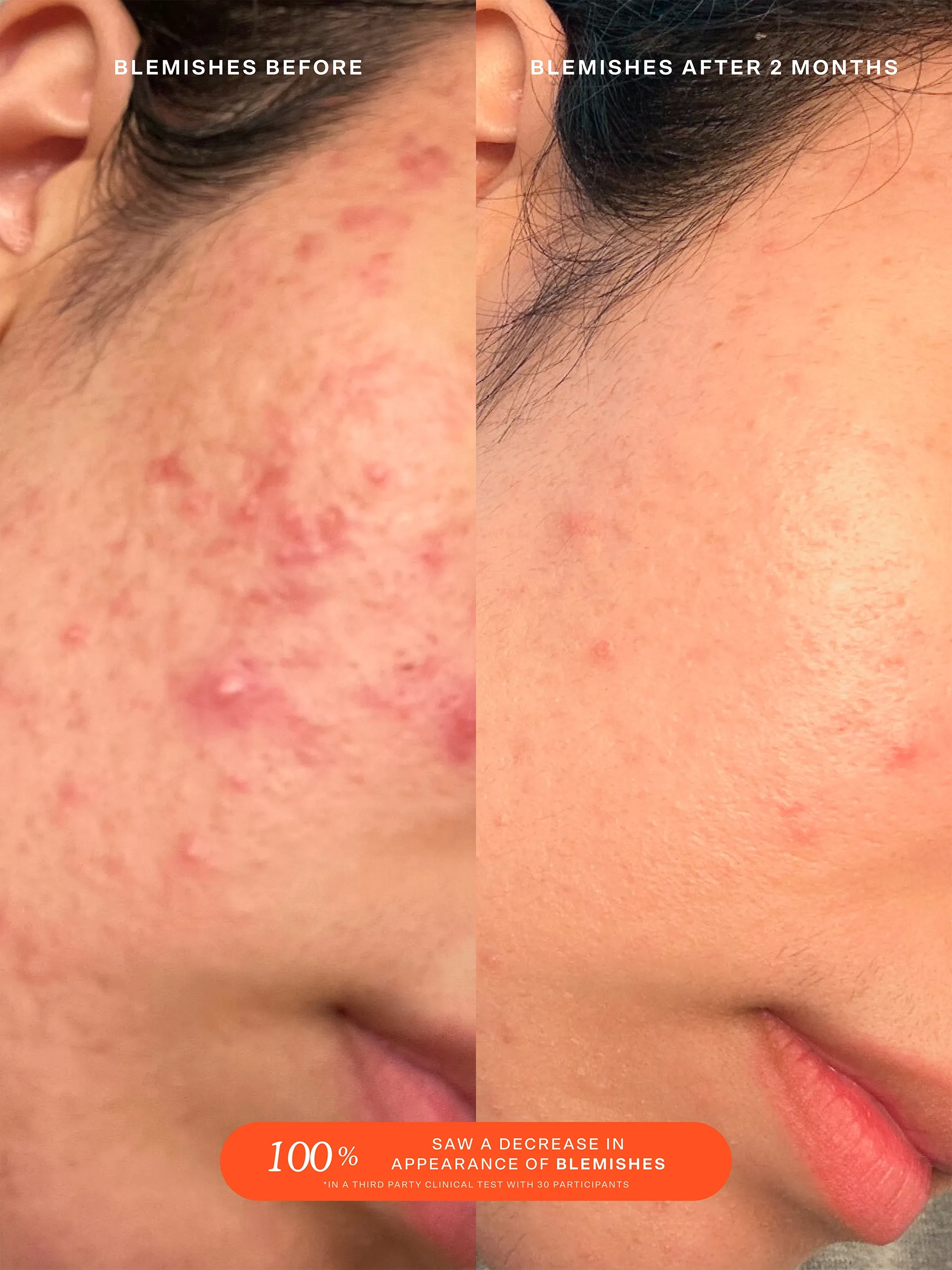 SOS Daily Rescue Facial Spray