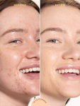 Alternative Image Tower28 Sunny Days SP F30 Tinted Sunscreen