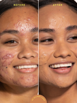Alternative Image Tower28 Sunny Days SP F30 Tinted Sunscreen