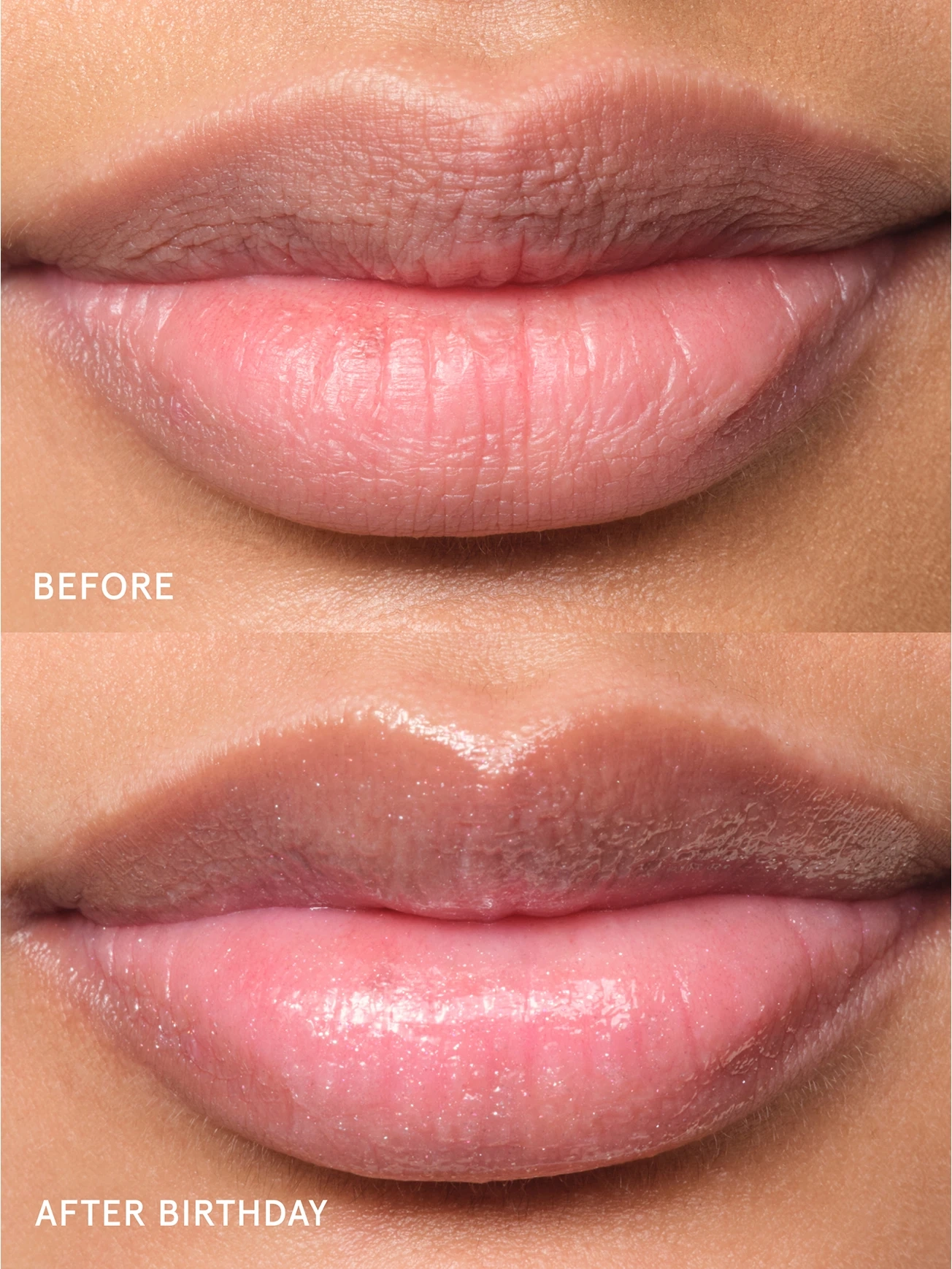 Alternative Image Glossier Balm Dotcom Lip Balmand Skin Salve