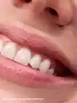 Alternative Image Glossier Balm Dotcom Lip Balm And Skin Salve