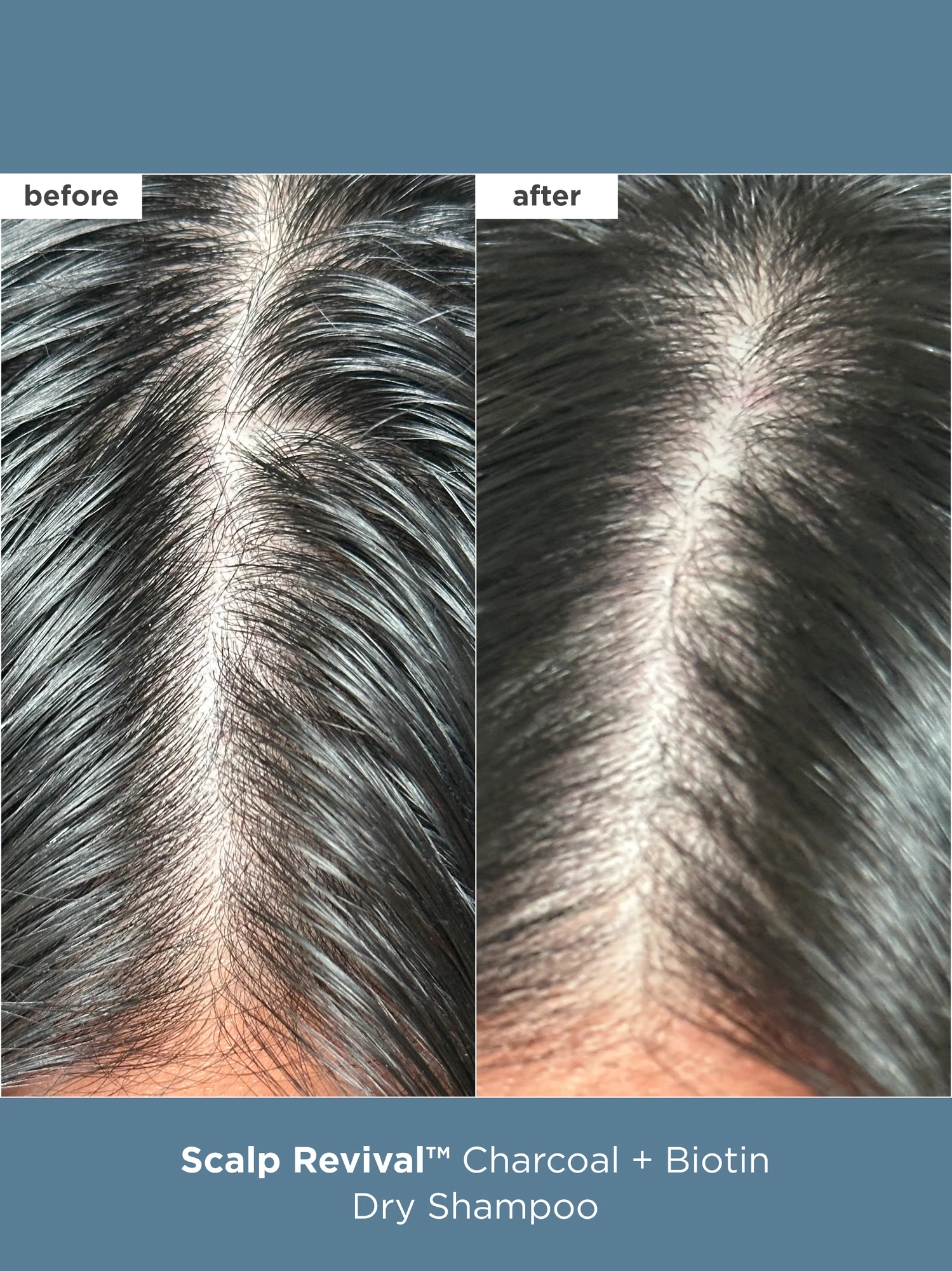 Alternative Image Briogeo Scalp Care Essentials Set