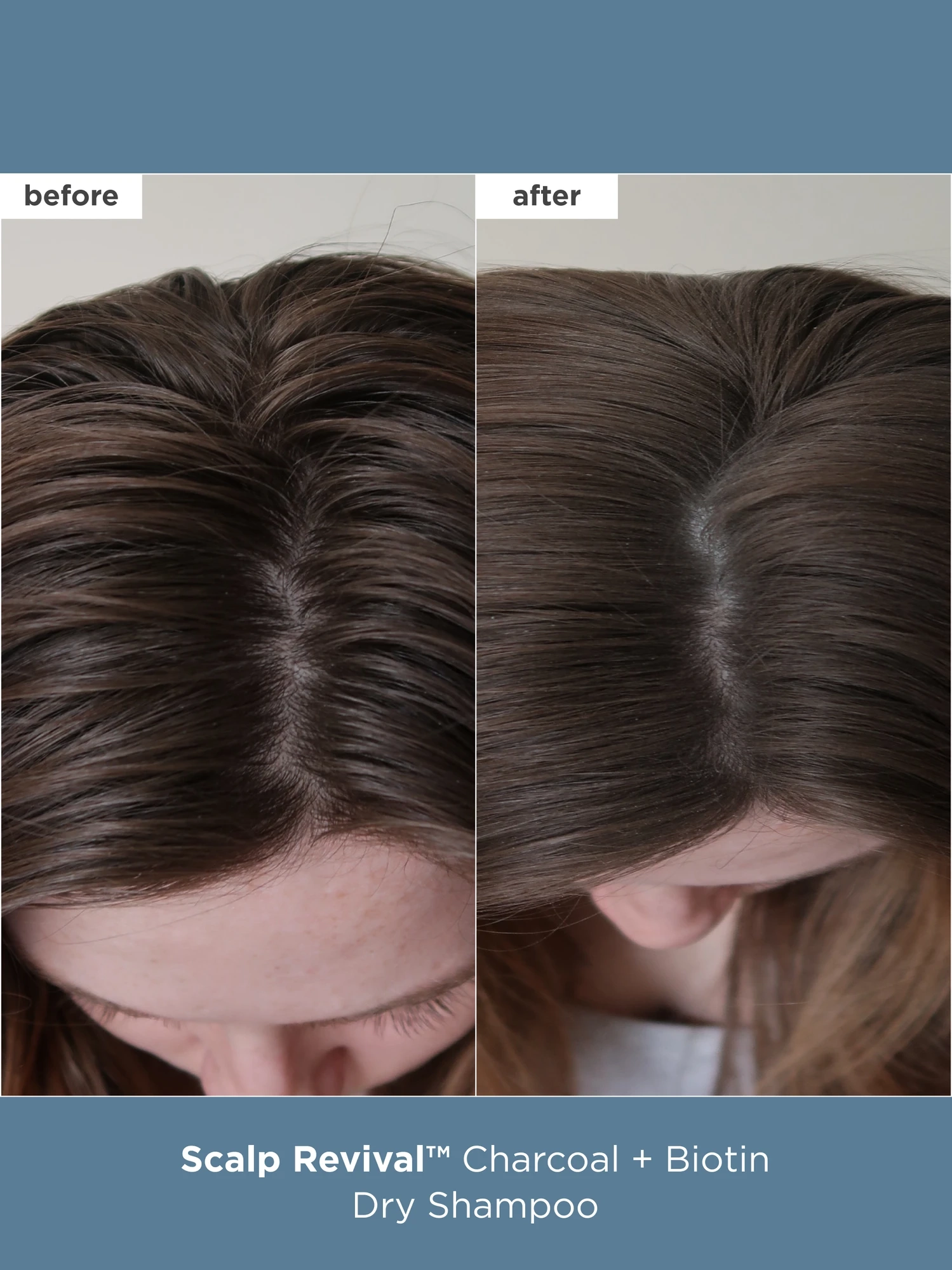 Alternative Image Briogeo Scalp Care Essentials Set